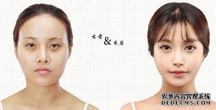 穆雄铮做颌面整形手术怎么样?多少钱?